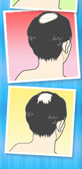 あなたの頭皮を今すぐチェック!